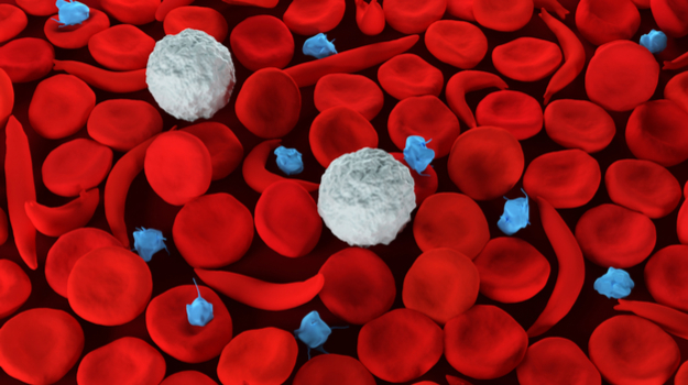 Sickle Cell Disease and Thalassemia 
